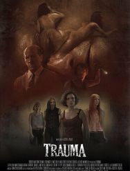 Травма